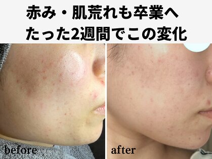 エアル(earu.)の写真