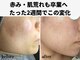 エアル(earu.)の写真