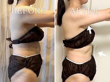 ヨサパーク サナ 二子玉川(YOSA PARK SANA)の雰囲気（実績あり◎モニター様を募集中（顔出しなし/11回実績））