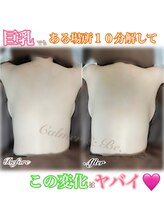 カルマーアンドビー(Calmer & Be.)/【バスト】Before/After