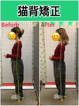 しんりふ接骨院/猫背矯正