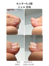 ノイルム(noilm)/爪質質改善