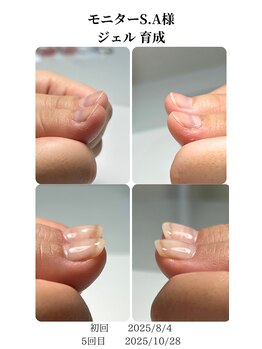 ノイルム(noilm)/爪質質改善