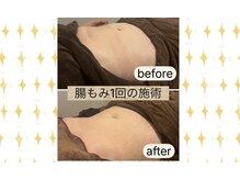 アネクル(ANECUL)/