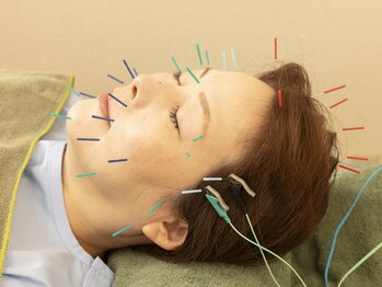 一二三鍼灸マッサージ治療院の写真/美容鍼の技術でたるみ・小じわ・むくみケア◎顎関節・首肩こり・眼精疲労も解消♪