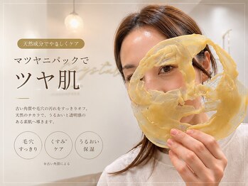 クリスタルの写真/【話題のマツヤニパック】産毛・毛穴汚れをケア♪つるんとなめらかな素肌へ導く人気サロン
