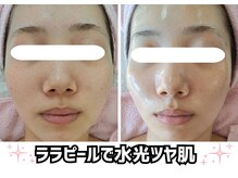 リアウェイク(Reawayke)の雰囲気（大人気のララピール♪20代～60代まで幅広く人気です！）