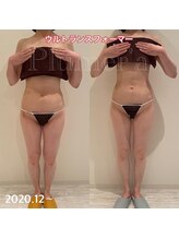 プルメリア(Plumer’a)/食事制限、リバウンドなし♪