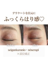 ロータス(LOTUS)/美小顔デザイン（目もと）