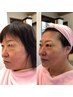 【若々しい見た目へ】】リフトアップフェイシャルエステ　60分