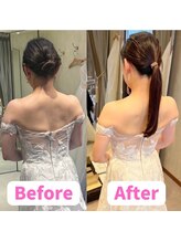 リアン整体院/肩甲骨はがしで背中美人に★