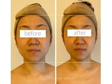 パル コルギサロン(Pal. Korugi salon)/コルギビフォーアフター