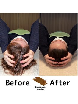 クマの冬眠 高知店/アタマほぐし