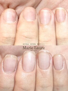 マリーロール 梅田店(Marie Laure)/自爪育成/深爪矯正/ネイルケア