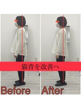 かたぎ整体組 徳島店/施術前／施術後