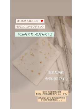 サロンド シェリー(Salon de Cherie)/毛穴エクストラクション