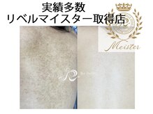フロージア 新宿南口店(FLOGIEIA)/小顔ハーブピーリングフロージア