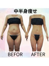 サロンド ヴィーナス 葛西店/人気の中半身痩せ★お腹すっきり