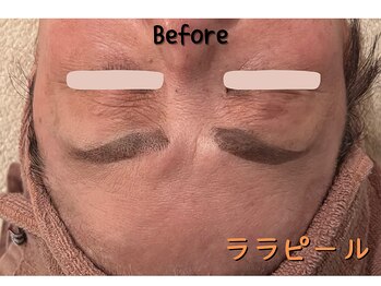 ダイヤモンド リーエンダ(Diamond leende)/ララピール