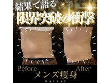 ラフィール/メンズ：腹斜筋：下っ腹施術