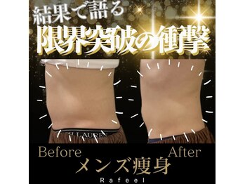 ラフィール/メンズ：腹斜筋：下っ腹施術