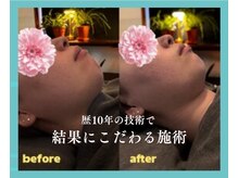 ヒトヒ(HITOHI)