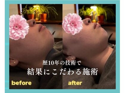 ヒトヒ(HITOHI)の写真