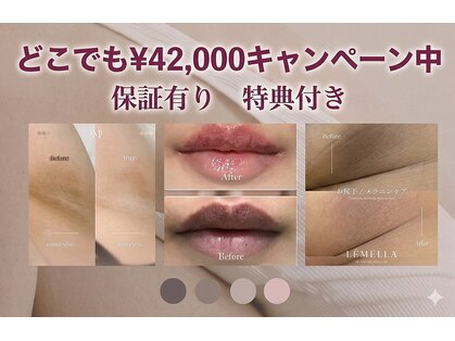 サロンヴィヴィ 大阪心斎橋店(salon ViVi)の写真