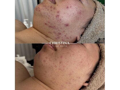 シグネット(Cygnet)の写真