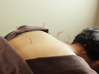 ハリコ 代官山の写真/メンズも大歓迎！日々のお仕事の蓄積がある肩こり、腰痛などに。丁寧な施術で整えます！