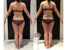 リボディ 表参道(An re Body)/before→after