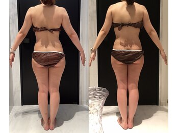 リボディ 表参道(An re Body)/before→after