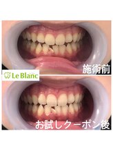 ルブラン 奈良店(Le Blanc)/沢山のメリットがありますよ