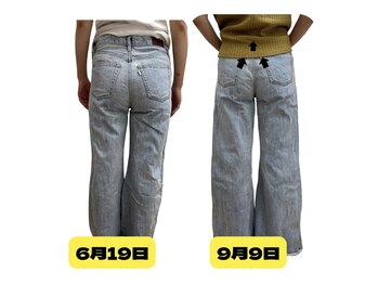 リボーン(Be.Reborn)/産後骨盤のゆがみ