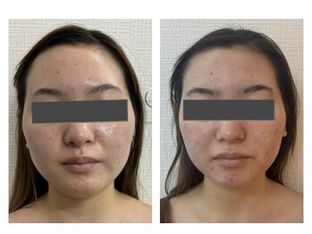 ザ ワン(THE ONE)/アジャスト3Dフェイシャル