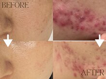 スキニティ(Skinity)