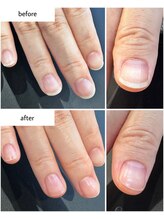 ケアプラス(care plus)/ハンドネイルケア