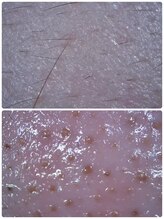 マリエンドリー/肌診断