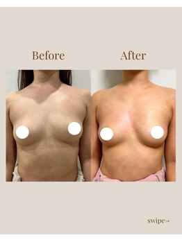 リネア(Linea)/【Before→After】30代前半