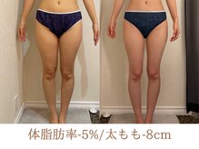 美ジン なかもず(美JIN)/セルゼロ全身12回