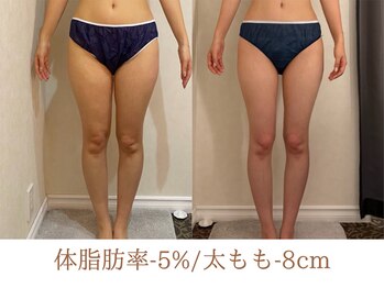美ジン なかもず(美JIN)/セルゼロ全身12回