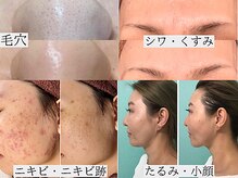 サロンドエルサ(Salon de ELSA)