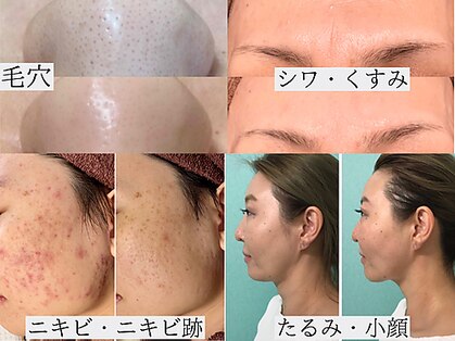 サロンドエルサ(Salon de ELSA)の写真
