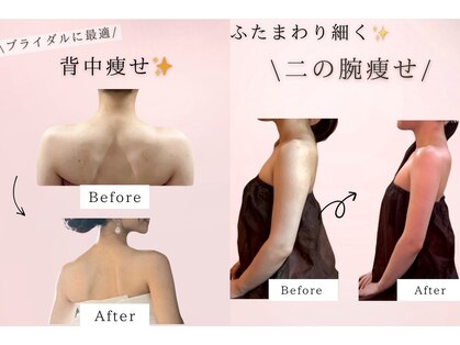 シャルロット(Charlotte)の写真