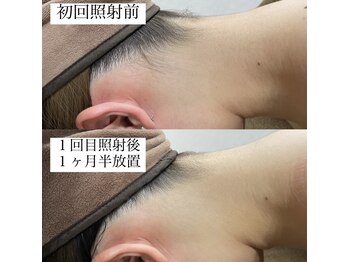 テンパ ビューティー(+10%beauty)/効果写真