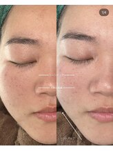 サンク(cinq)/韓国で大人気メニュー☆彡