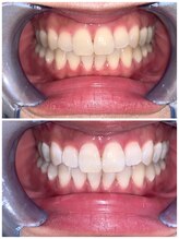 ライトビューティー 池袋店(LightBeauty)/症例写真