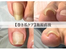 ラネイル(Ra Nail)の雰囲気（初回の施術で巻き爪の痛みから即日解放！見た目も自然と大好評♪）
