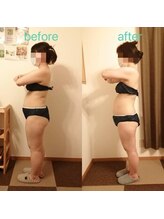 アンジュ/ハイパーナイフ全身贅沢コース