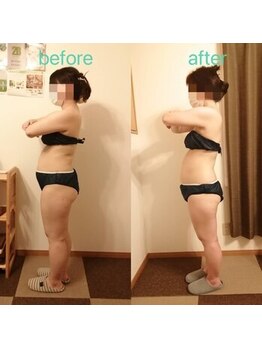 アンジュ/ハイパーナイフ全身贅沢コース